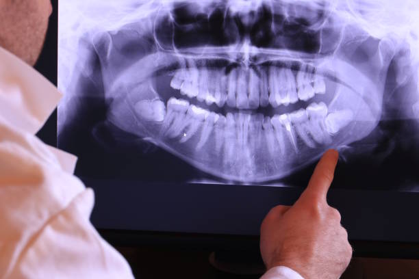 Best Chipped Tooth Repair Near Me  in Brambleton, VA